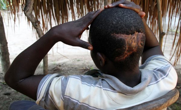 Claude, Survivor of December 2009 atrocities in the Makombo area of Haut-Uélé district, DRC